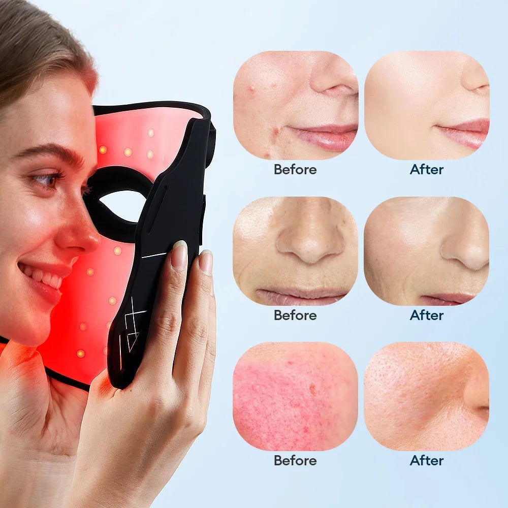 7-Color Silicone LED Face Mask
