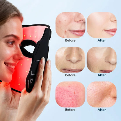 7-Color Silicone LED Face Mask