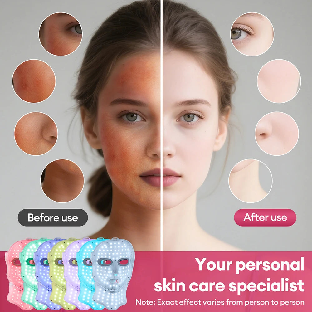 Wireless 7-Color LED Face & Neck Mask